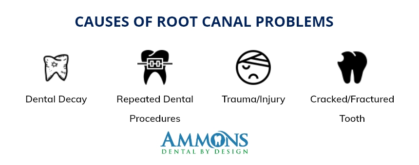 Causes of Root Canal Problems Infographic